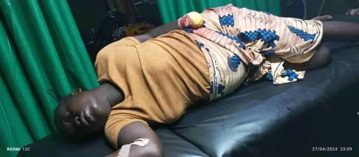 Ehn! Police Inspector don cut im wife hand for Jos sake of N20,000 (See Photos)